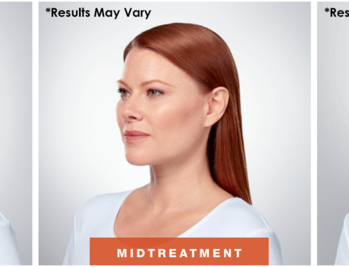 How Much Does Kybella Cost?