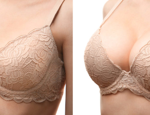 How Long Does Breast Augmentation Surgery Take?