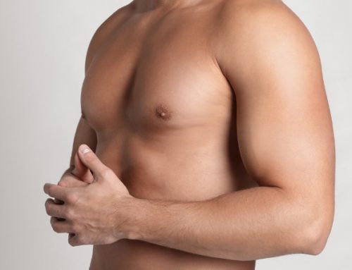 How Long is Recovery from Gynecomastia?