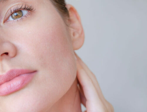 What to Expect During a Laser Acne Treatment