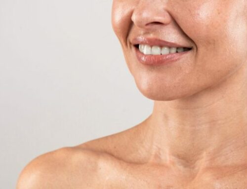 How Long Does Kybella® Last?