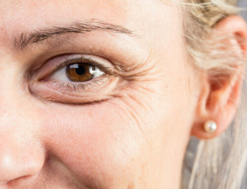 Am I a Good Candidate for an Eyelid Lift (Blepharoplasty)?